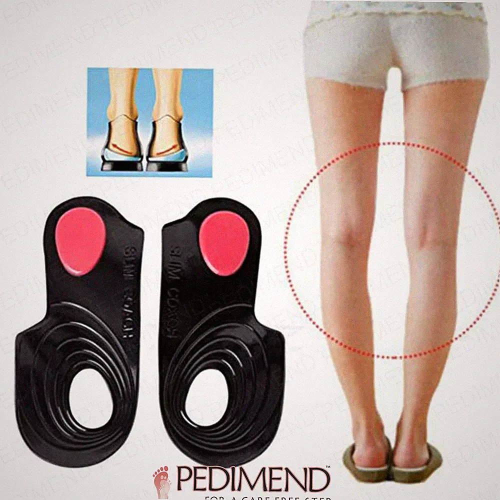 PEDIMEND Gel Füße Schmerzkorrektur Pads - O/X Typ Bein orthopädisch beste Einlegesohlen UK