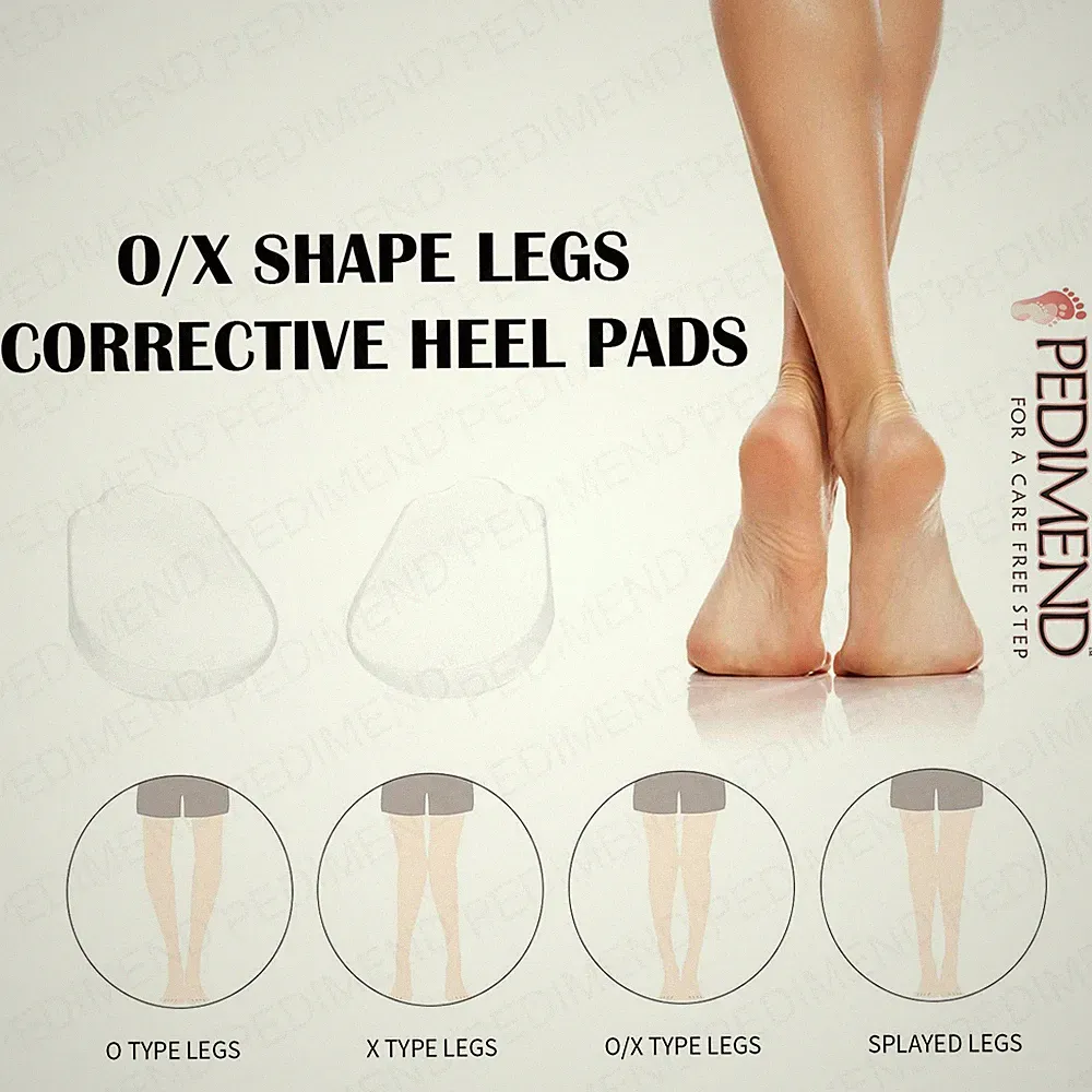 Pedimend™ orthopädische Einlegesohlen zur Korrektur von O/X-Beinen und klopfenden Knieschmerzen