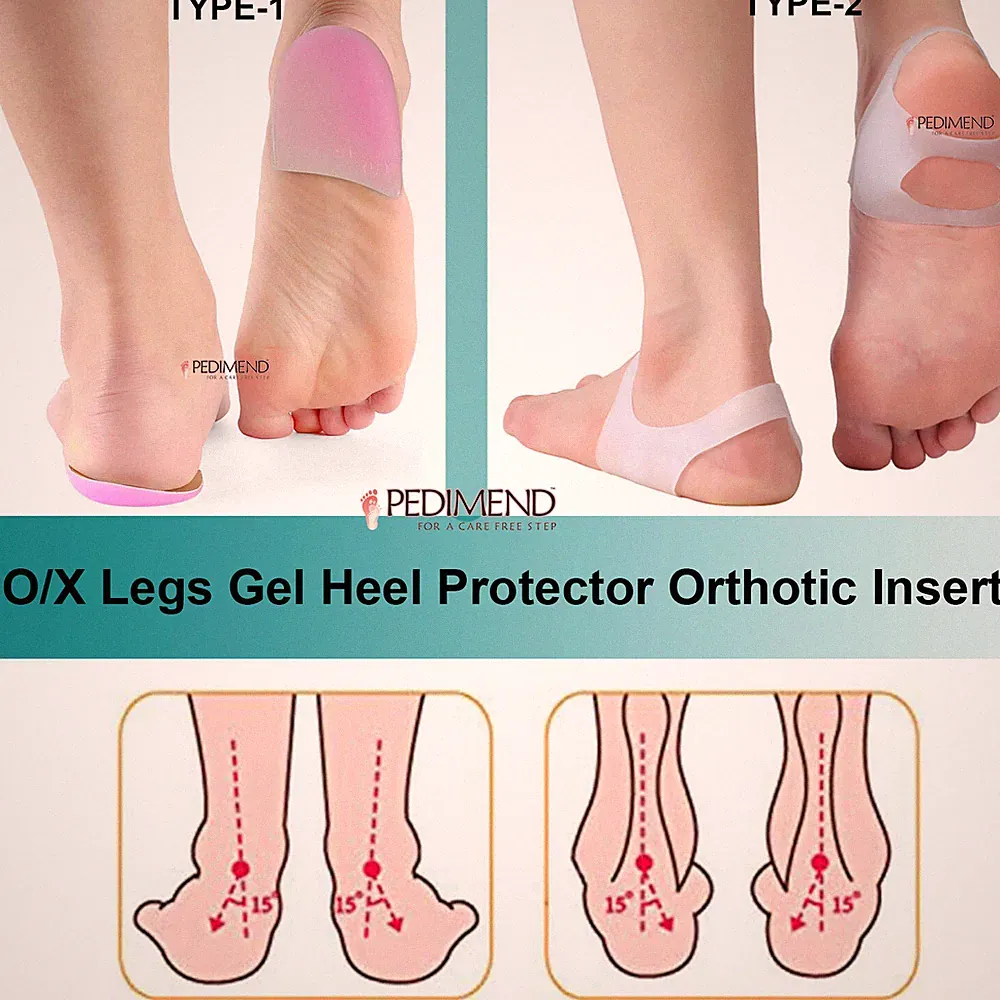 Pedimend™ Silikon Fuß Valgus Corrector - einzigartiges Design für O/X-Form Beine - UK