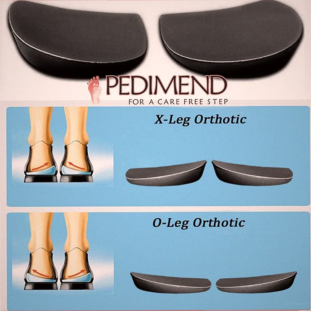 PEDIMEND Supination & Pronation korrigierende Ferseneinlegesohlen für O/X Typ Beine 1 PAAR