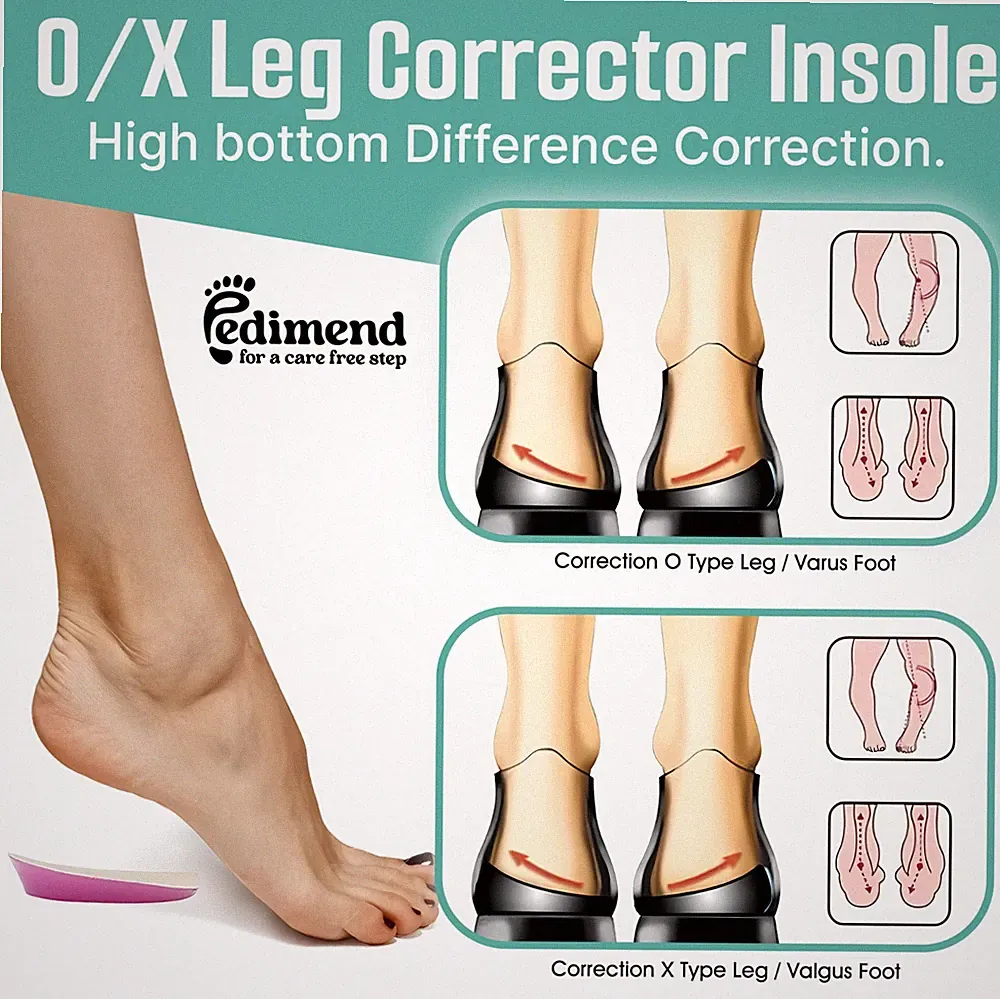 PEDIMEND™ Supination & Überpronation korrigierende Schuheinlagen für O/X Typ Beine